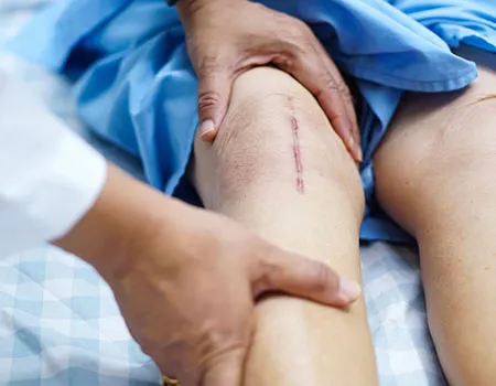 Fisioterapia postoperatoria en L'Eliana